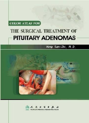 Color Atlas for the Surgical Treatment of Pituitary Edonemas