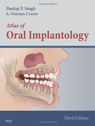 ATLAS OF ORAL IMPLANTOLOGY 3E