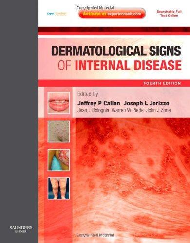 DERMATOLOGICAL SIGNS OF INTERNAL DISEASE ELSE