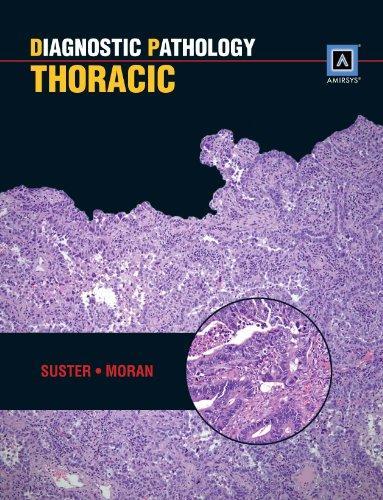 Diagnostic Pathology: Thoracic: Published by Amirsys(r)