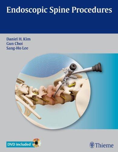 Endoscopic Spine Procedures (With DVD)