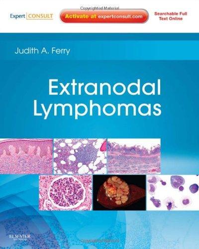 Extranodal Lymphomas: Expert Consult - Online and Print