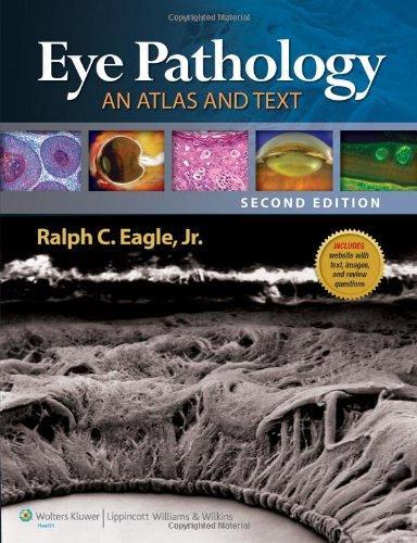 Eye Pathology: An Atlas and Text 