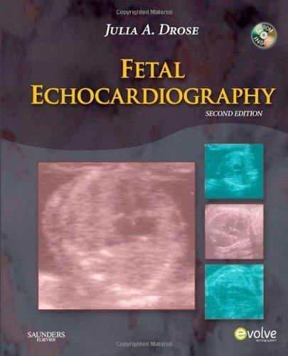 Fetal Echocardiography, 2e 