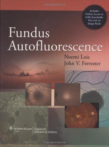 Fundus Autofluorescence