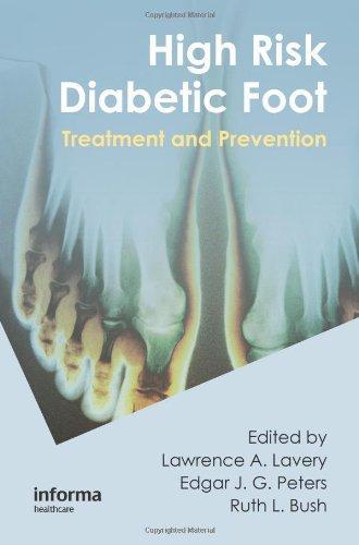 High Risk Diabetic Foot:Treatment and Prevention