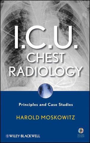 I.C.U. Chest Radiology: Principles and Case Studies 