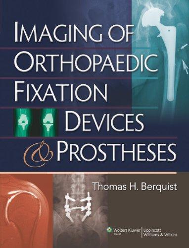 Imaging of Orthopaedic Fixation Devices and Prostheses