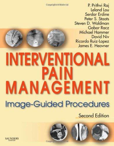 Interventional Pain Management: Image-Guided Procedures with DVD, 2e