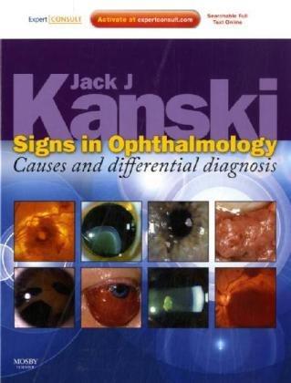 Signs in Ophthalmology: Causes and Differential Diagnosis: Expert Consult - Online and Print, 1e
