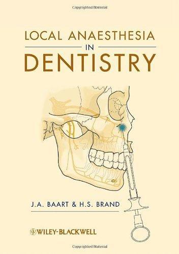 Local Anaesthesia in Dentistry