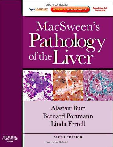 MacSween's Pathology of the Liver