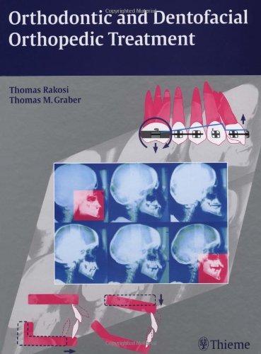Orthodontic and Dentofacial Orthopedic Treatment