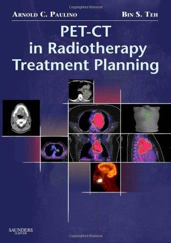 PET-CT in Radiotherapy Treatment Planning