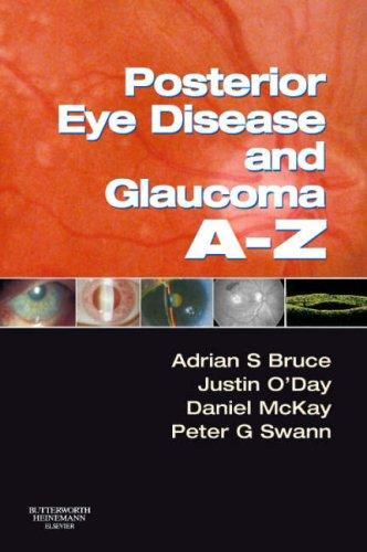 Posterior Eye Disease and Glaucoma A-Z