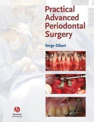 Practical Advanced Periodontal Surgery