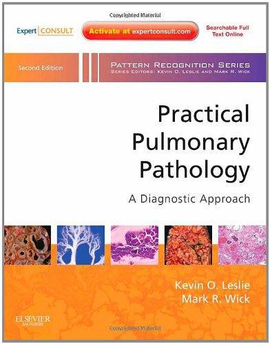 Practical Pulmonary Pathology: A Diagnostic Approach: A Volume in the Pattern Recognition Series, Expert Consult: Online and Print