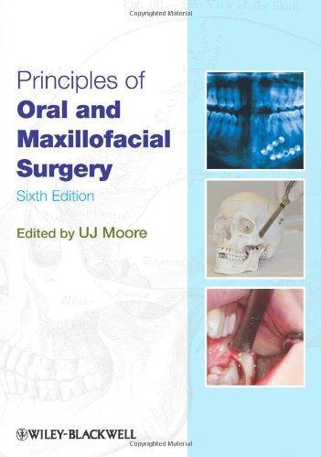 Principles of Oral and Maxillofacial Surgery