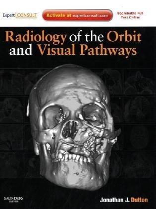 Radiology of the Orbit and Visual Pathways [With Access Code]