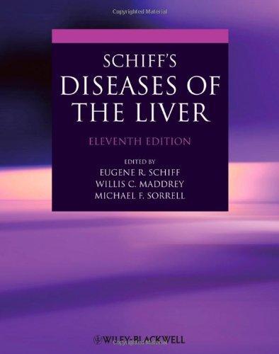 Diseases Of The Liver