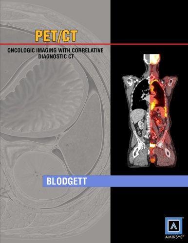 PET/CT: Oncologic Imaging with Correlative Diagnostic CT