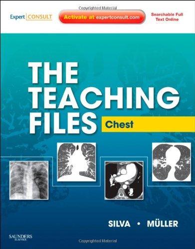 The Teaching Files: Chest: Expert Consult - Online and Print, 1e (Teaching Files in Radiology) 