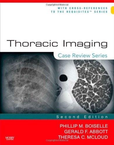 Thoracic Imaging