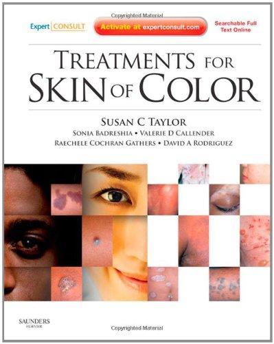TREATMENTS FOR SKIN OF COLOR:EXPERT CONSULT-O