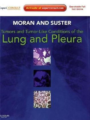 Tumors and Tumor-Like Conditions of the Lung and Pleura