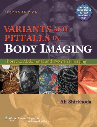 Variants and Pitfalls in Body Imaging: Thoracic, Abdominal and Women's Imaging 