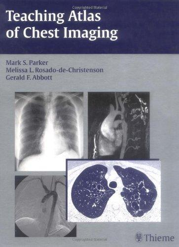 Teaching Atlas of Chest Imaging