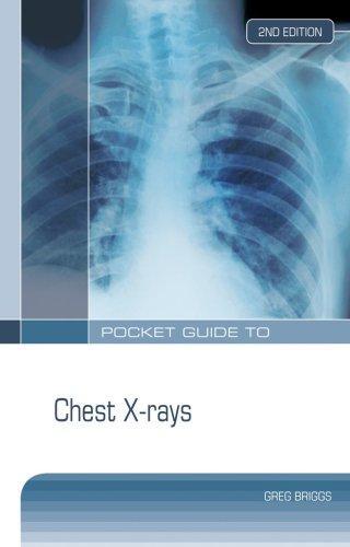 Pocket Guide to Chest X-Rays