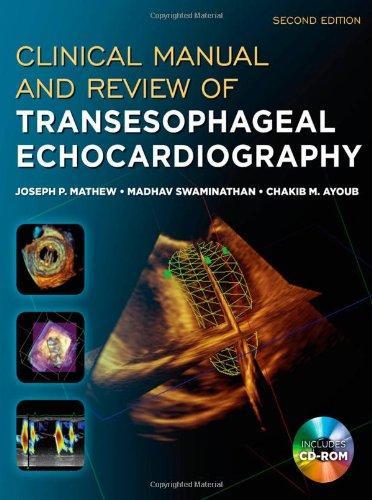 Clinical Manual and Review of Transesophageal Echocardiography, Second Edition