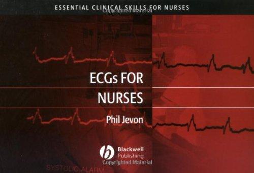 ECGs for Nurses (Essential Clinical Skills for Nurses) 