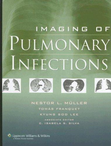 Imaging of Pulmonary Infections 