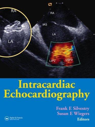 Intracardiac Echocardiography 