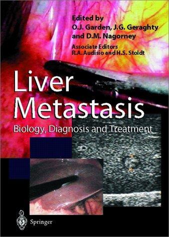 Liver Metastases: Biology, Diagnosis and Treatment 