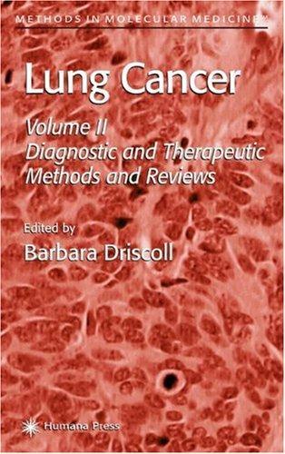 Lung Cancer: Volume 2: Diagnostic and Therapeutic Methods and Reviews (Methods in Molecular Medicine) 