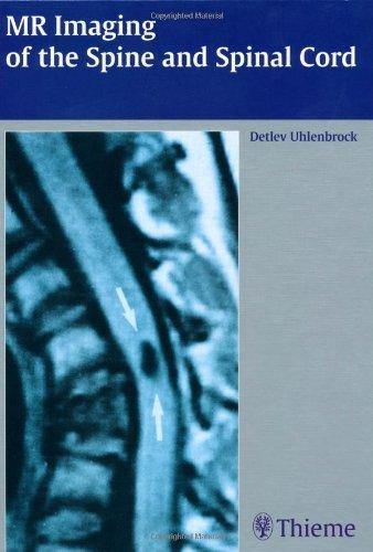 Mr Imaging of the Spine and Spinal Cord