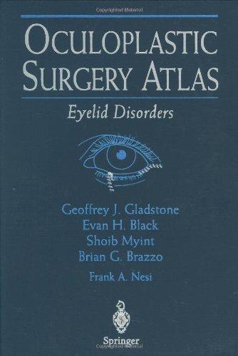 OculoplasticSurgery Atlas: Eyelid Disorders