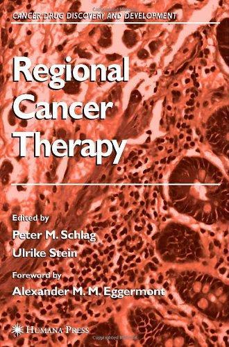 Regional Cancer Therapy (Cancer Drug Discovery and Development) 