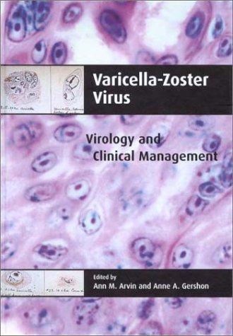 Varicella-Zoster Virus: Virology and Clinical Management 