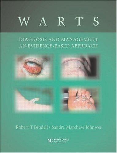 Warts: Diagnosis and Management: An Evidence Based Approach 