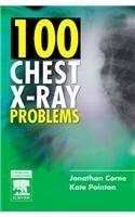 100 Chest X-Ray Problems