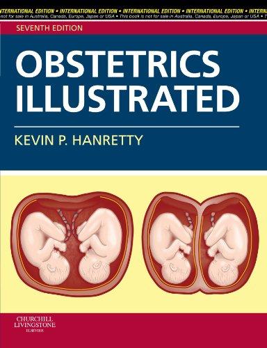 OBSTETRICS ILLUSTRATED, 7/E IE