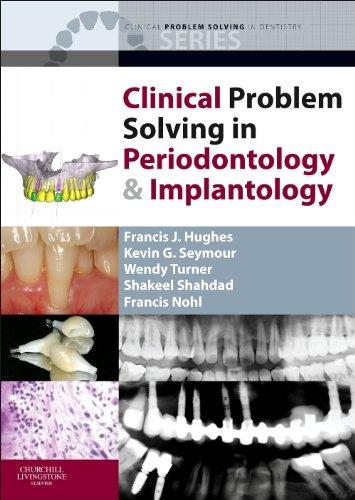  Clinical Problem Solving in Periodontology and Implantology, 1e 