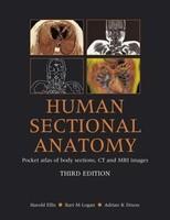 Human Sectional Anatomy: Atlas of body sections, CT and MRI images, Third Edition