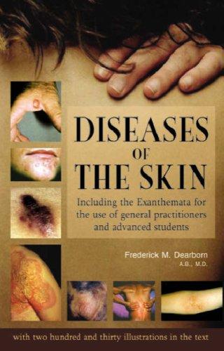Diseases of the Skin With Illustrations