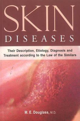 Skin Diseases