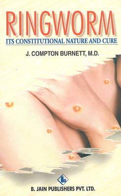 Ringworm: Its Constitutional Nature and Cure